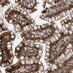 FAM135B Antibody in Immunohistochemistry (Paraffin) (IHC (P))