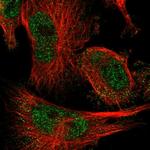 C17orf70 Polyclonal Antibody