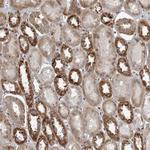 C17orf70 Antibody in Immunohistochemistry (Paraffin) (IHC (P))