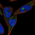 ZNF583 Polyclonal Antibody