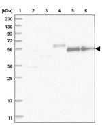 ZNF583 Antibody in Western Blot (WB)