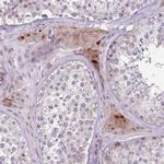 ZNF583 Antibody in Immunohistochemistry (IHC)