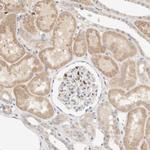 TTC3 Antibody in Immunohistochemistry (IHC)