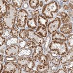 DHRS4 Antibody in Immunohistochemistry (Paraffin) (IHC (P))