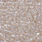 DHRS4 Antibody in Immunohistochemistry (Paraffin) (IHC (P))