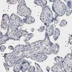 DHRS4 Antibody in Immunohistochemistry (Paraffin) (IHC (P))