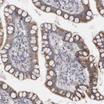 DHRS4 Polyclonal Antibody