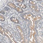 TUBD1 Antibody in Immunohistochemistry (Paraffin) (IHC (P))