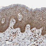 GIGYF1 Antibody in Immunohistochemistry (Paraffin) (IHC (P))