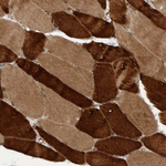 GIGYF1 Antibody in Immunohistochemistry (Paraffin) (IHC (P))