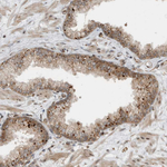 GIGYF1 Antibody in Immunohistochemistry (Paraffin) (IHC (P))