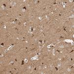 NBR1 Antibody in Immunohistochemistry (Paraffin) (IHC (P))