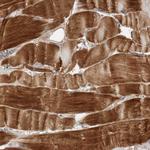 NBR1 Antibody in Immunohistochemistry (Paraffin) (IHC (P))