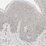 NBR1 Antibody in Immunohistochemistry (Paraffin) (IHC (P))