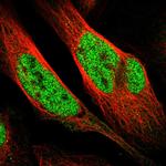 WIPF2 Polyclonal Antibody