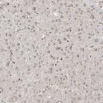 WIPF2 Antibody in Immunohistochemistry (Paraffin) (IHC (P))