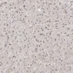 WIPF2 Antibody in Immunohistochemistry (IHC)