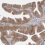 WIPF2 Antibody in Immunohistochemistry (IHC)