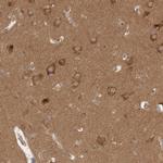 WIPF2 Antibody in Immunohistochemistry (IHC)