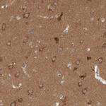 WIPF2 Antibody in Immunohistochemistry (IHC)