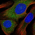 ALOX12B Polyclonal Antibody