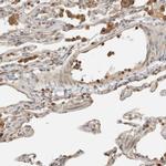 RAB11FIP1 Antibody in Immunohistochemistry (IHC)
