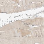 RAB11FIP1 Antibody in Immunohistochemistry (IHC)