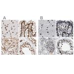 NIPA Antibody in Immunohistochemistry (IHC)