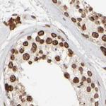 NIPA Antibody in Immunohistochemistry (IHC)