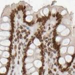 NIPA Antibody in Immunohistochemistry (IHC)