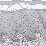 GBA2 Antibody in Immunohistochemistry (Paraffin) (IHC (P))