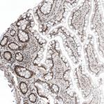 CAAP1 Antibody in Immunohistochemistry (Paraffin) (IHC (P))
