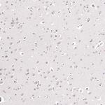 CAAP1 Antibody in Immunohistochemistry (Paraffin) (IHC (P))