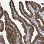 SPAG7 Antibody in Immunohistochemistry (IHC)