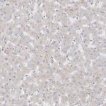 HPGDS Antibody in Immunohistochemistry (Paraffin) (IHC (P))