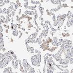 HPGDS Polyclonal Antibody