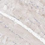 HPGDS Antibody in Immunohistochemistry (Paraffin) (IHC (P))