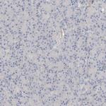 HPGDS Antibody in Immunohistochemistry (IHC)