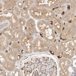 MSP Antibody in Immunohistochemistry (Paraffin) (IHC (P))