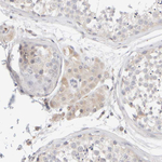 MSP Antibody in Immunohistochemistry (Paraffin) (IHC (P))