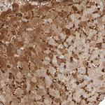 MSP Antibody in Immunohistochemistry (IHC)