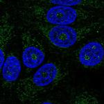 ABHDB Polyclonal Antibody