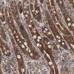ABHDB Antibody in Immunohistochemistry (Paraffin) (IHC (P))