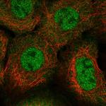 SKAP2 Polyclonal Antibody