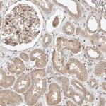 OTUD6B Antibody in Immunohistochemistry (IHC)