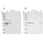 OTUD6B Antibody in Western Blot (WB)