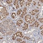 DCTN6 Antibody in Immunohistochemistry (Paraffin) (IHC (P))