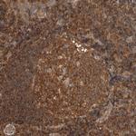 PFDN4 Antibody in Immunohistochemistry (Paraffin) (IHC (P))