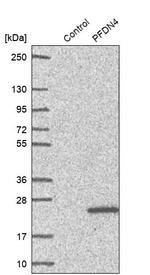 PFDN4 Antibody in Western Blot (WB)