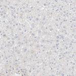 LMCD1 Antibody in Immunohistochemistry (IHC)